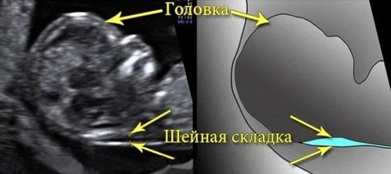 Сколько хромосом у человека здорового? Сколько хромосом у человека здорового?