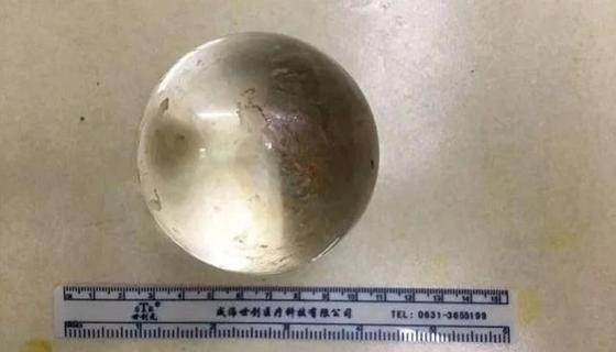 Любитель секс-игрушек засунул себе в задний проход большой шар и не смог его достать (фото) Любитель секс-игрушек засунул себе в задний проход большой шар и не смог его достать (фото)