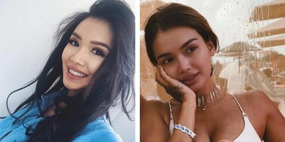 Айжан Байзакова (до и после предполагаемой операции). Фото: Instagram Айжан Байзакова (до и после предполагаемой операции). Фото: Instagram
