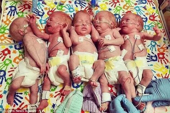 Әйелі бес баланы дүниеге әкелгенін естіген азамат шалқасынан түсе жаздады. Фото: life.ru Әйелі бес баланы дүниеге әкелгенін естіген азамат шалқасынан түсе жаздады. Фото: life.ru