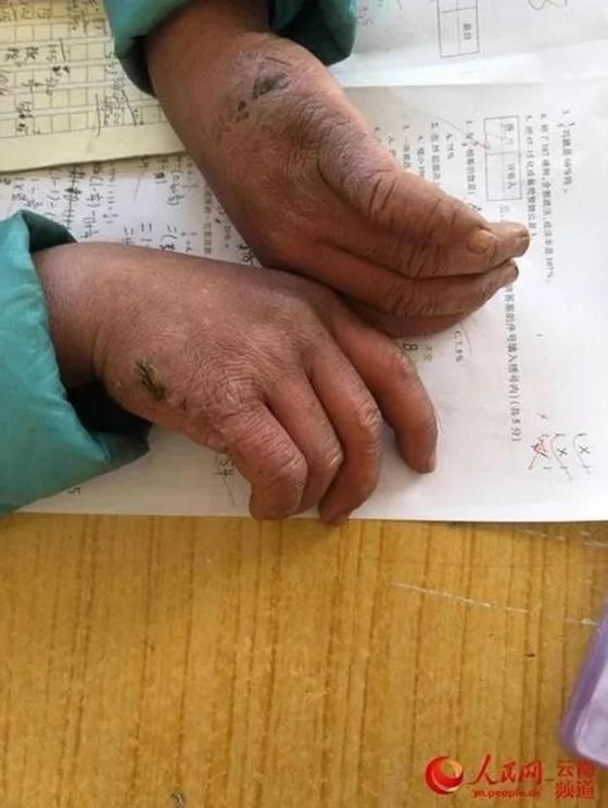 Қақаған аязда мектепке жаяу келген балақайдың шашы мұзға айналып кетті (фото) Қақаған аязда мектепке жаяу келген балақайдың шашы мұзға айналып кетті (фото)
