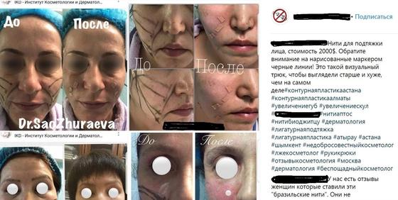 Алматылық дәрігердің қабылдауында болған қыз-келіншектер адам шошырлық күйге түсті (фото) Алматылық дәрігердің қабылдауында болған қыз-келіншектер адам шошырлық күйге түсті (фото)