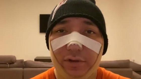 Әлішер Кәрімов отадан кейін Әлішер Кәрімов отадан кейін
