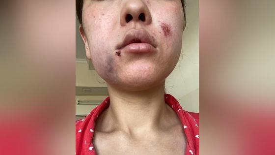 Бывший муж избил женщину в Туркестанской области Бывший муж избил женщину в Туркестанской области
