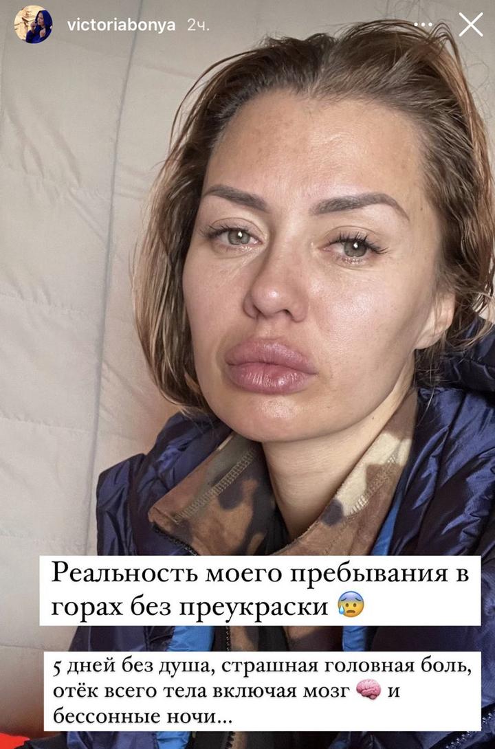 Фото виктории бони после пластики 2025