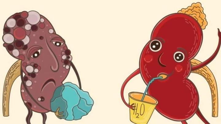 Песок в почках, камни и соли симптомы, лечение, причины